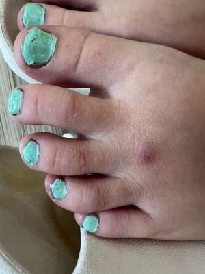 My daughter's toe nails