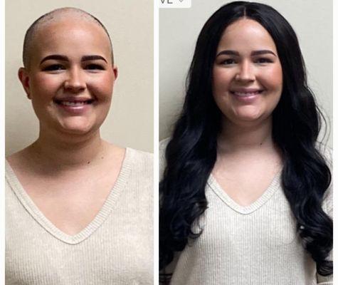 Cancer wigs / 
Cranial Prosthesis