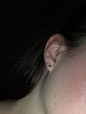 lobe piercing from this morning next to keloid scarring from previous piercing issue