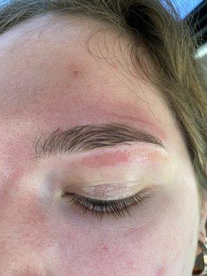 Freshly waxed eyebrow with the skin waxed off