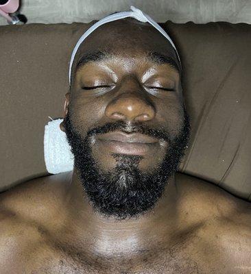 Mens Rejuvenation Facial