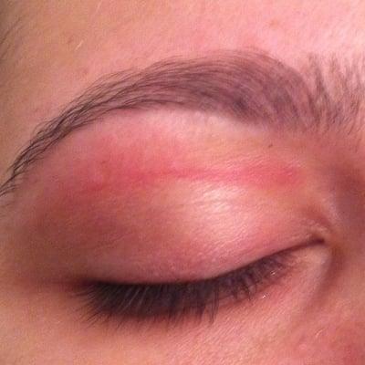 This was when I got my eye brows waxed on the first day it was extremely swollen and puffy, too sensitive to light