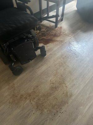 Close up picture of stain on living room floor