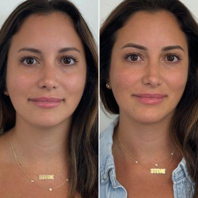 Before & after, immediately after nano brows procedure