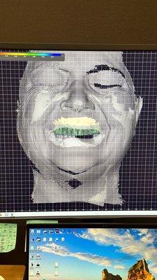 Facial scan image