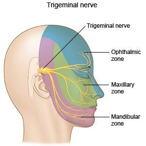 Acupuncture for Bell's Palsy