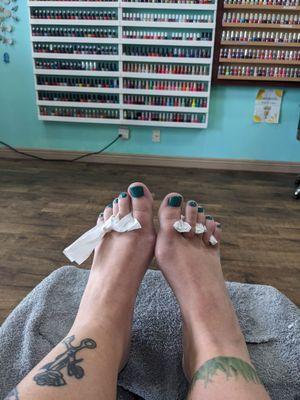 Pedicure