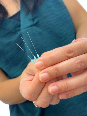 Acupuncture needles to induce a calm relaxed state