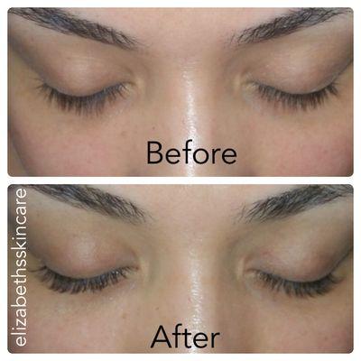 Eyelash Lift