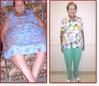 Linda lost 131 pounds