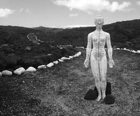 Acupuncture on the BIg Island