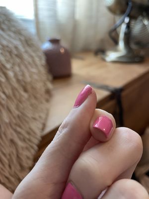 Chipped thumb