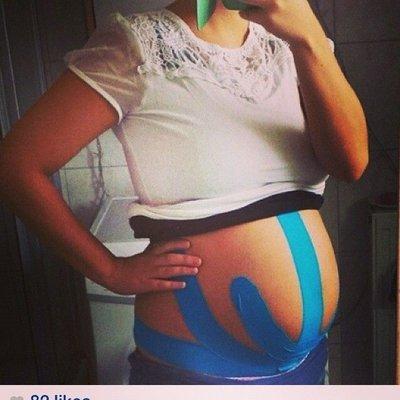 Rock Tape to relieve the stress of pregnancy.