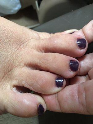 Pedicure wasn't done right left old skin and bad nail polish job