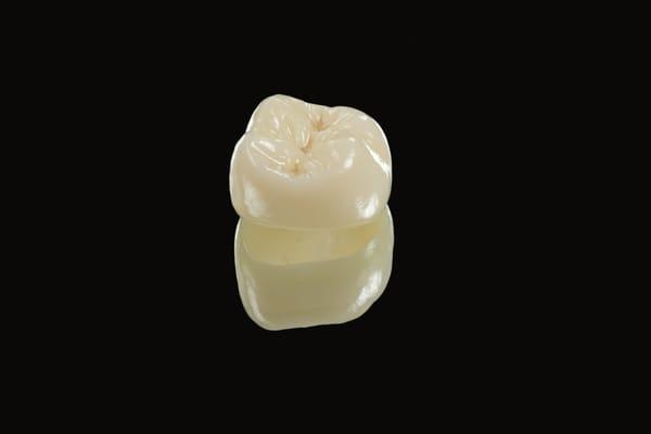 Full Contour Zirconia Crown