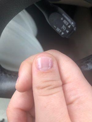 Trimmed my natural nail terribly