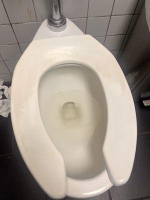 nasty toilet seat