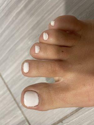 A terrible pedicure