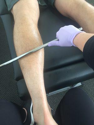 Graston Technique to treat  calf tightness.