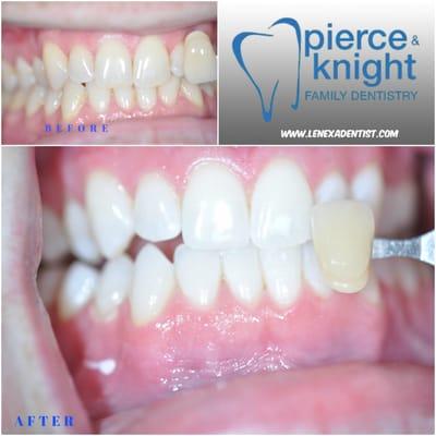 Pierce & Knight Family Dentistry