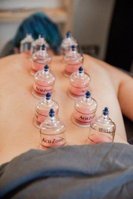 Cupping lifts tissue to help remove restriction