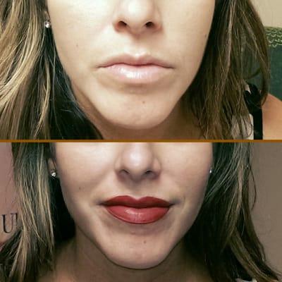 Permanent Lips Post Treatment