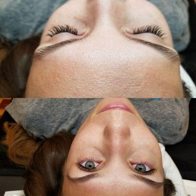 Eyelash extensions