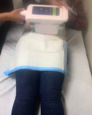 One of our clients using the cool plas (fat freezing) machine.