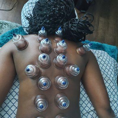 Sports Massage w/Cupping