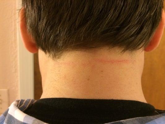 Hairline not cleaned up, and neck gouged by razor. You can also see the uneven cut over my ear.