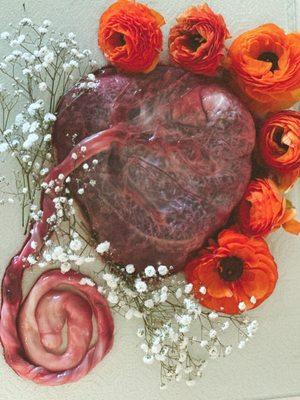 Placenta pictures for all clients available with your choice of flowers or herbs to decorate it