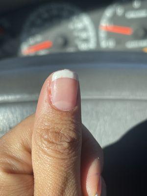 messy cuticle