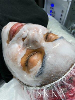 The Oxygen Facial