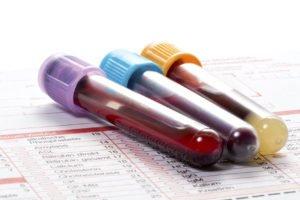 Order your own blood tests