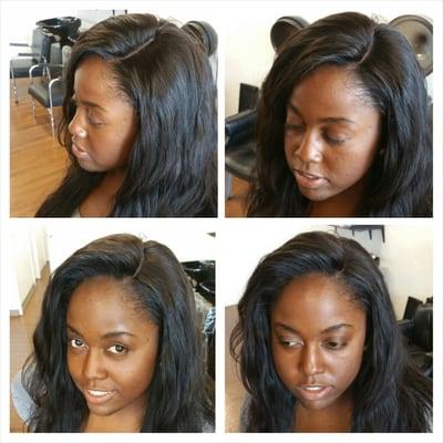 Lace closure install