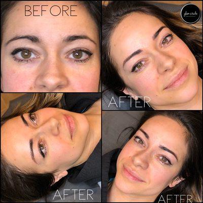 Microblading and microshading