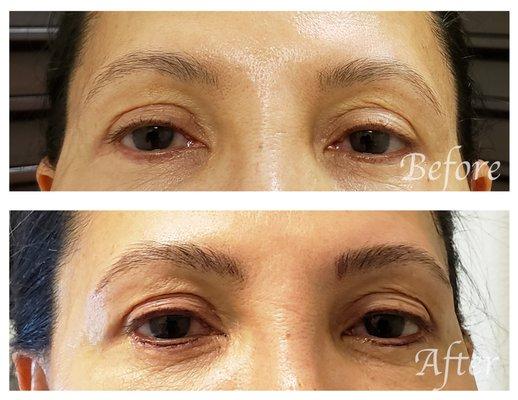 Microblading