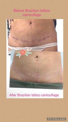 Brazilian camouflage tattoo. To cover scars and stretch marks