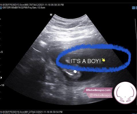 It's a boy!