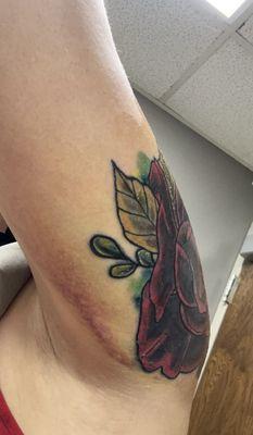 Huge bruise from 2nd tattoo