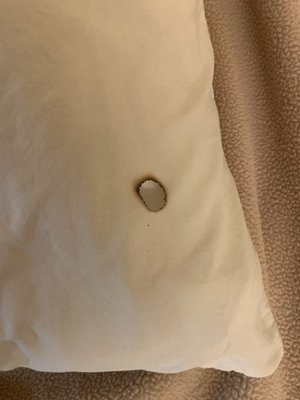 cigarette burn in pillowcase