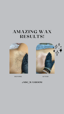 Brazilian Wax Before and After!