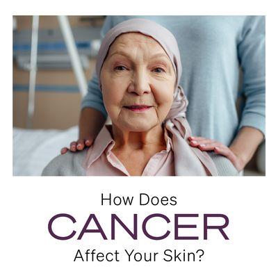 facial Treatments for cancer patients