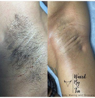 Underarm Wax