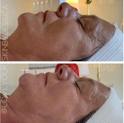 Just Skin Signature Facial