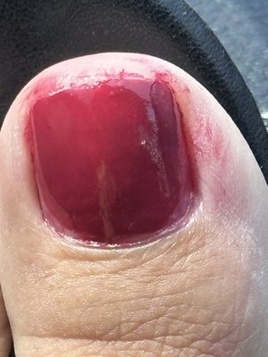 Horrible Pedicure