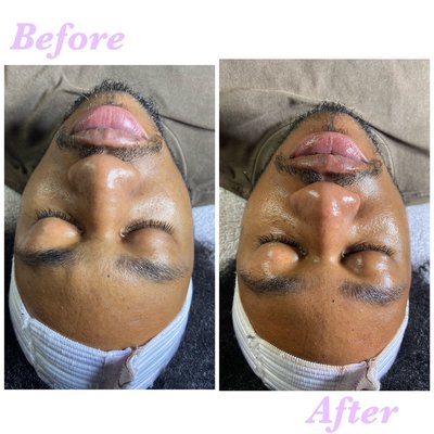 Men's charm facial