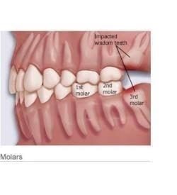 Oral Surgeon Pearland, TX