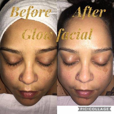 Glow facial