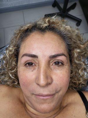 MIcroblading